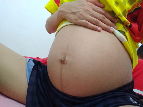 37w แล้ว