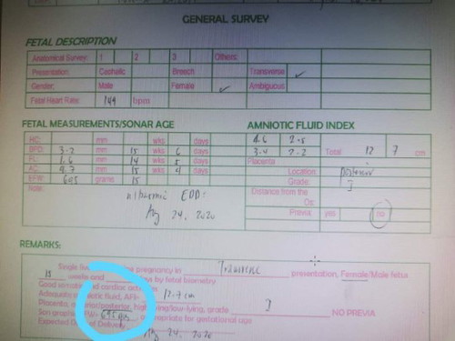 Ultrasound result 695 grams.?