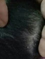 kulit kepala bayi