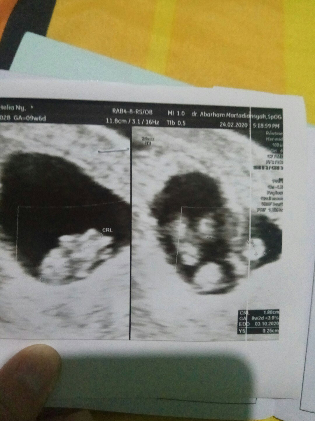 Hamil 9 Minggu Tp Kata Dokter Banyi Saya Meninggal..