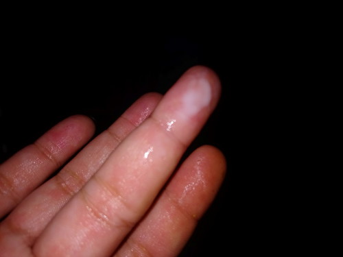 Ra Dich Như Thế Nay Co Phai Dấu Sanh Gi Đó