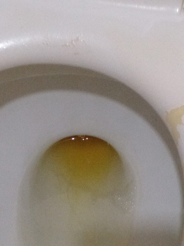 madilaw ihi