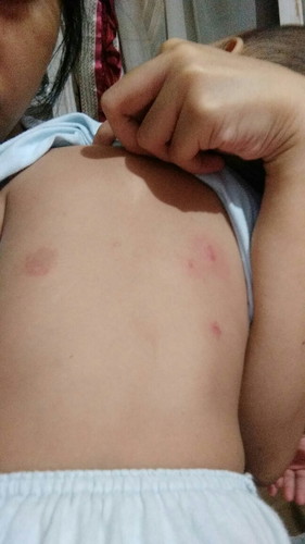 anak suka menggigit