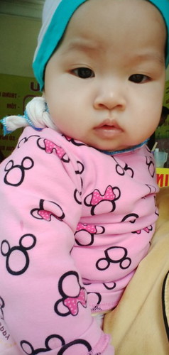 trẻ đc gần 9 tháng ra mũi xanh có sao không