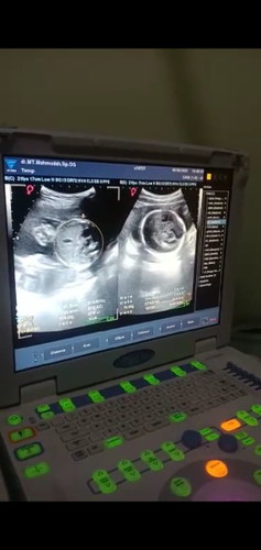 adakah yang sama hpl mei,??