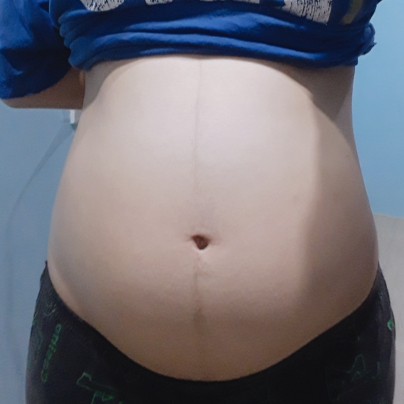 ท้องแรกค่ะ