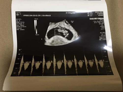 แชร์ประการณ์