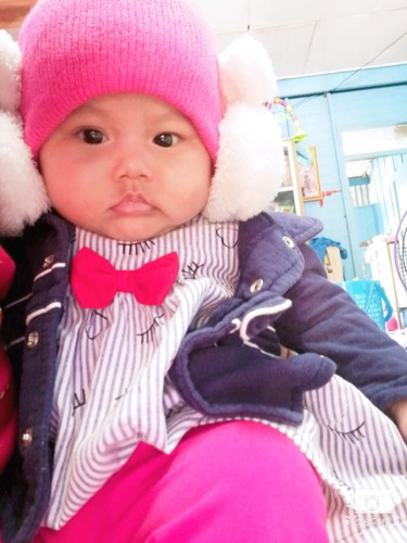 ผิวหน้าน้องแห้งลอกเป้นขุยๆแม่ๆใช้อะไรทาบ้างค่ะเคยใช้ออยแร้วแต่น้องแพ้ค่ะเป้นแต่ที่หน้าค่ะตามตัวไม่เป้นน้อง3เดือน13วัน