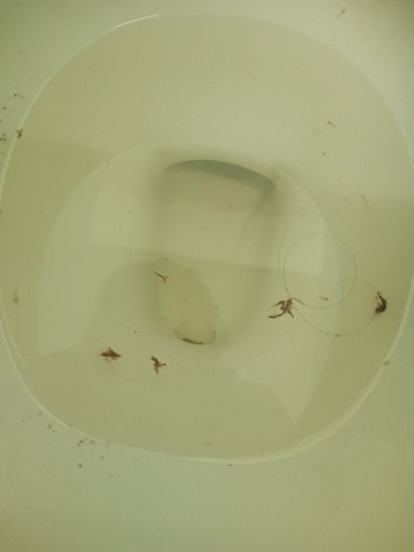 อัลตร้าซาวด์  18/03/63  09.30น.