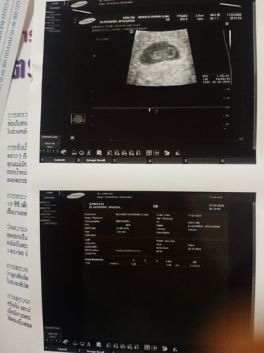 แท้งคุกคาม โพสวันที่ 18/03/63 11.50 น.