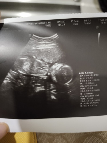ทีม พ.ย. 19/11/63 17w1d