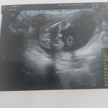 ผมมีจู๋คับ