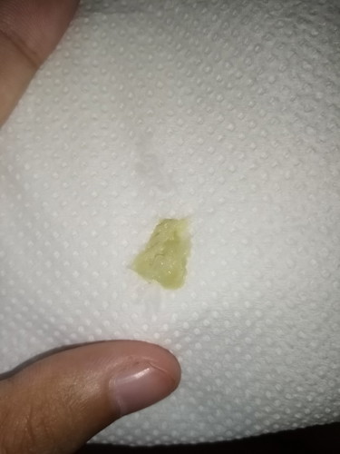 อันตรายมั้ยคะ