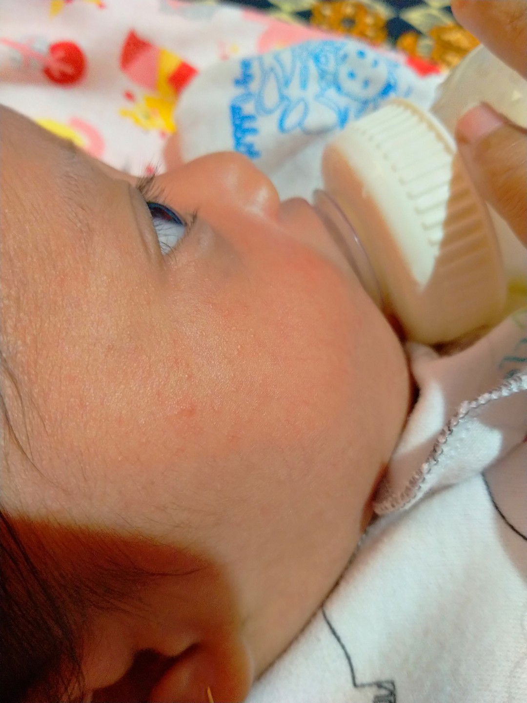 bintik merah di wajah bayi