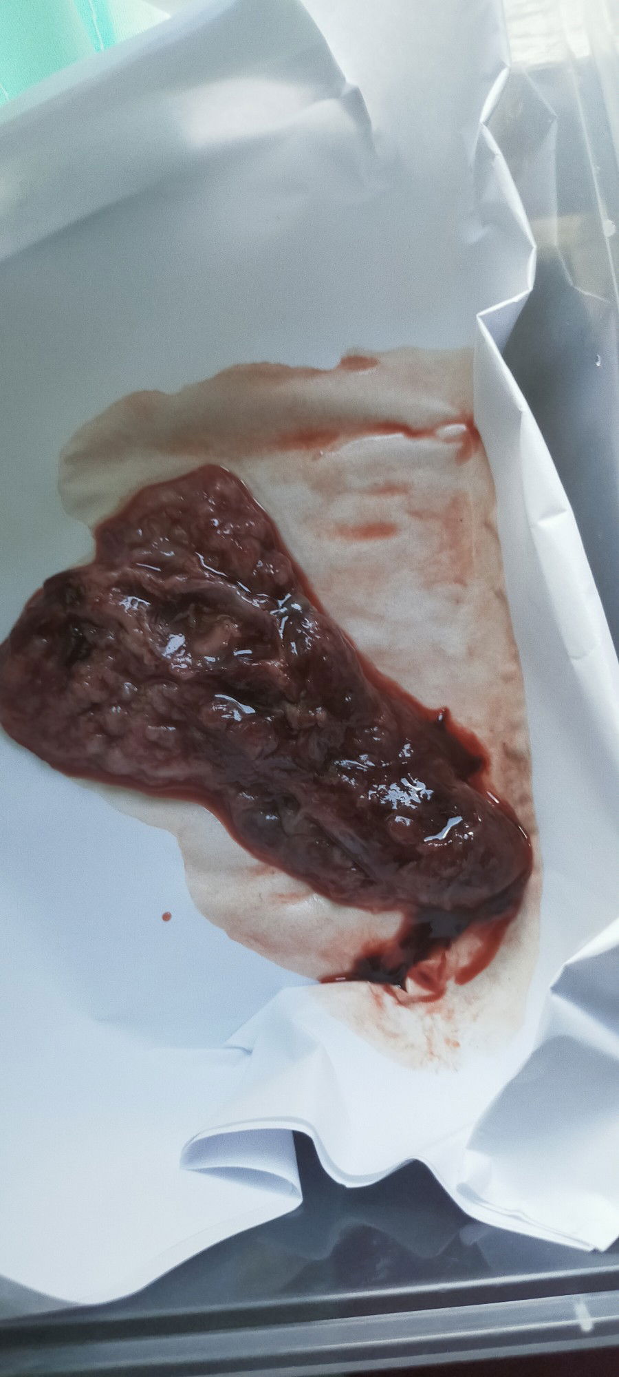 baby ko d na kinaya kumapit..