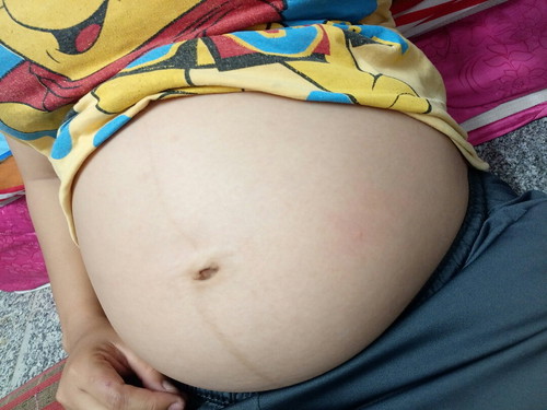 เพศลูก