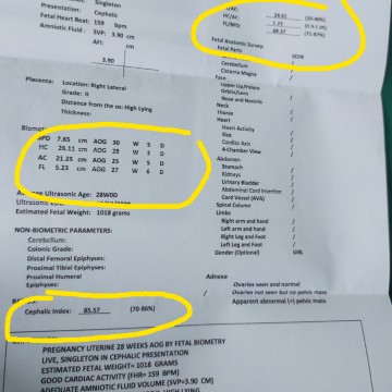 malaki ulo
