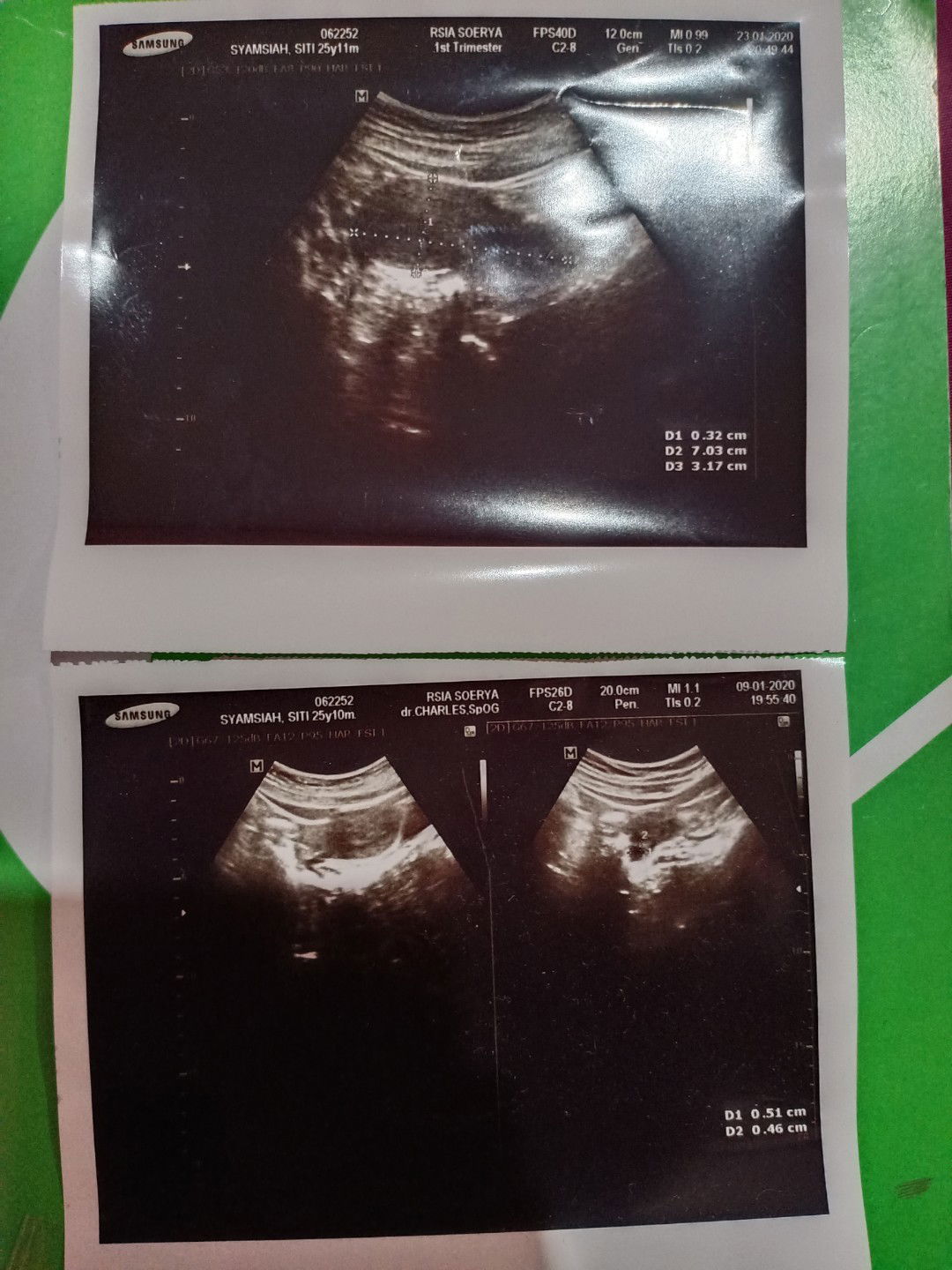 Hamil atau keguguran