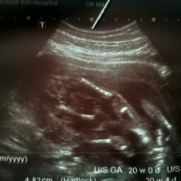 น้องอยู่ท่าไหนคะแม่ดูไม่ออก