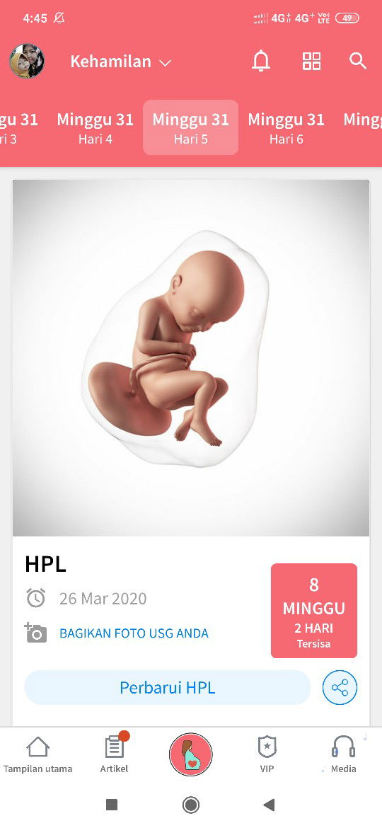 Usia kehamilan 31 minggu lebih