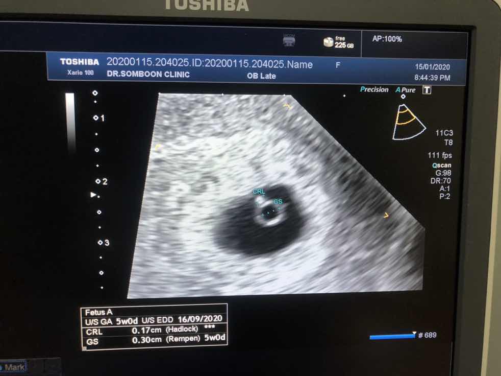 มองเห็นเจ้าตัวน้อยละคับ??