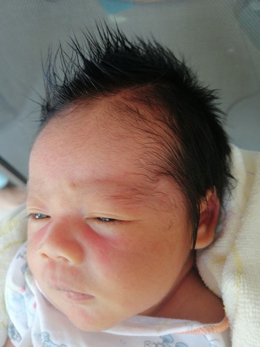 ตรวจตัวเหลือง