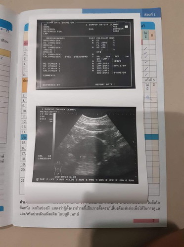 10วีค2วันแล้ว มีแม่คนไหนท้องหนาๆทั้งครับ ยังมองไม่ค่อยเห็นลูกเรย