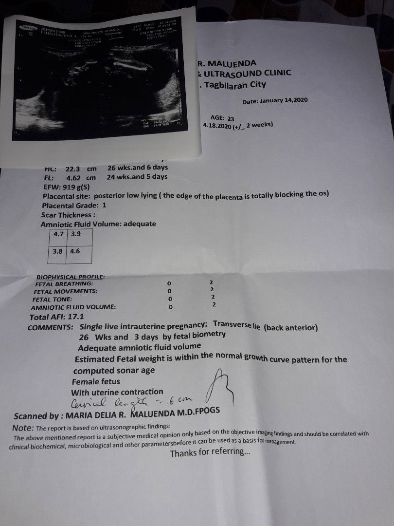 masakit po yung kiliran ko , lalo na pag gumagalaw si baby .. nag pa ultrasound ako last wed. ito po yung resulta sa ultrasound ko.