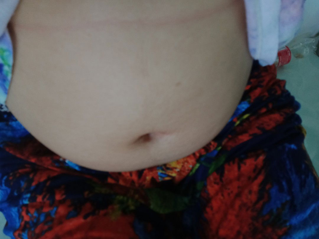 căng cả bụng ??