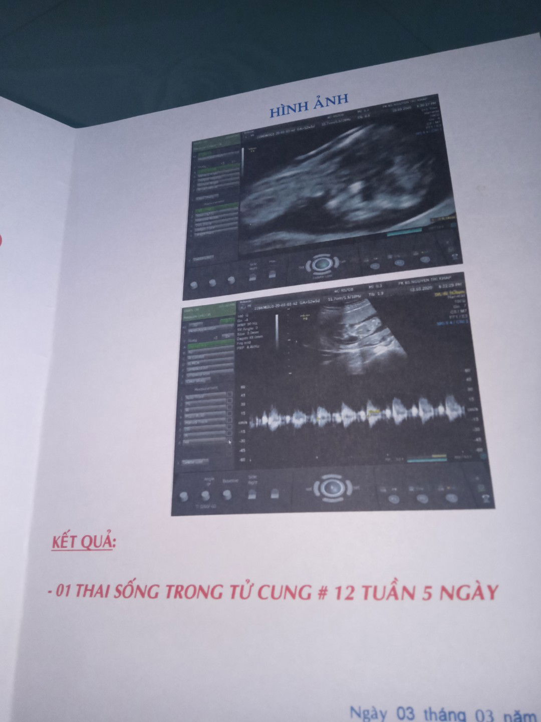 Được nhìn thấy cục cưng của mẹ rồi ?