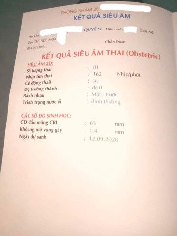 tại vì sao lại có em ??