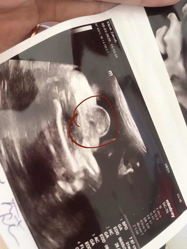 31w 1st bby