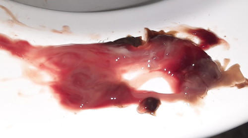 hi mga mommies !! im 39 weks and 1 day