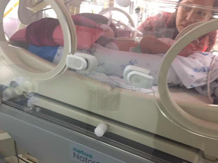 คลอดก่อนกำหนด 32+ 5