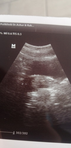first baby