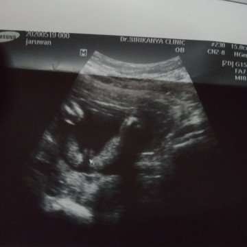 เพศอะไร