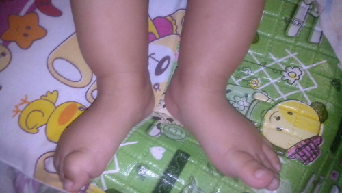 Bentuk Kaki