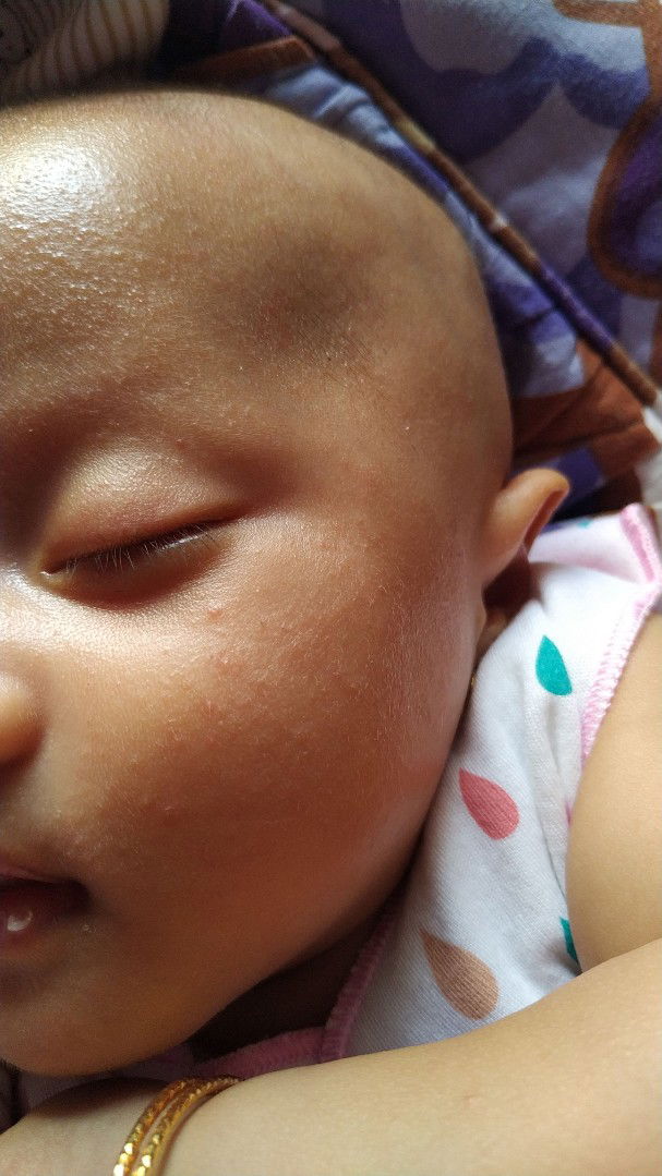 biang keringat bukan?