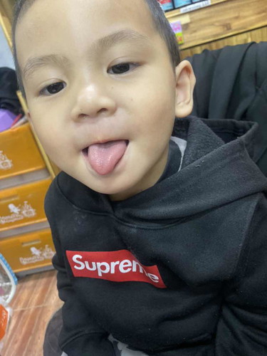ลูกชายอายุ2ขวบ7เดือนแล้วยังพูดไม่ชัดเลยแถมตอนนี้พูดติดอ่างอีก