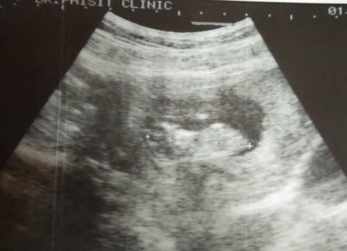 ขอดูทีมกันยายนหน่อยจ้า