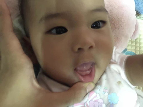 ฟันซี่แรก