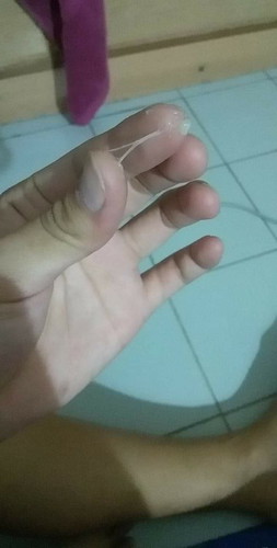 กังวล