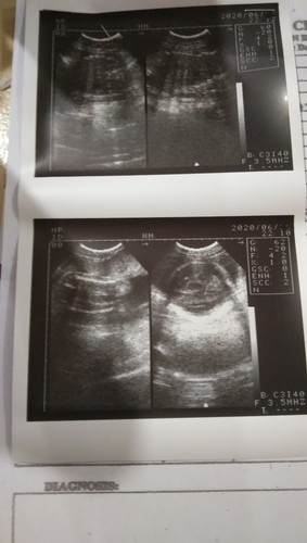 Gender?