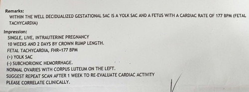 Fetal Tachycardia