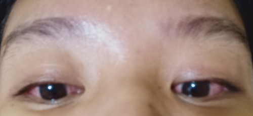 hi mga mommies