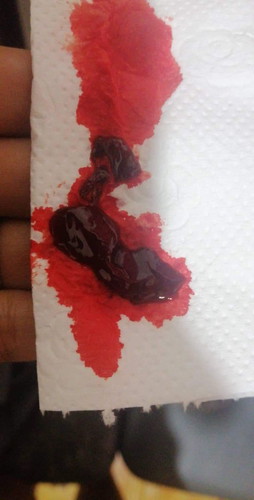 Bleeding