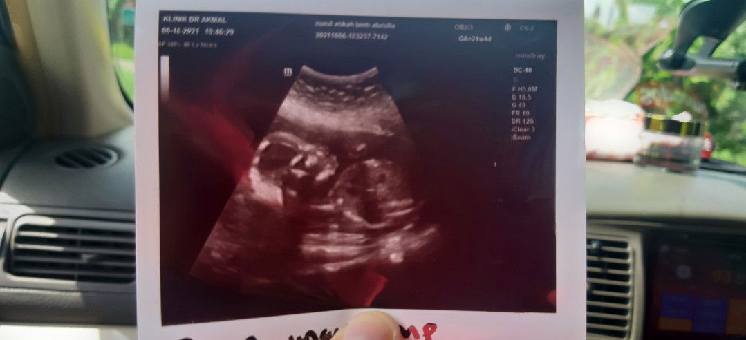 Nurul Atikah profile icon