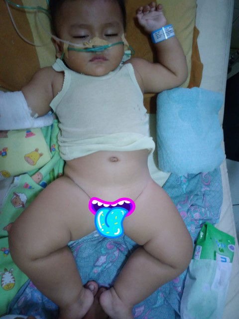 untuk yg ke 3x nyh di rawat