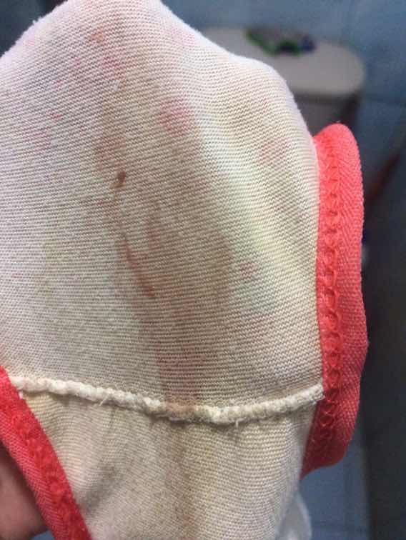 37weeks & 6Days today