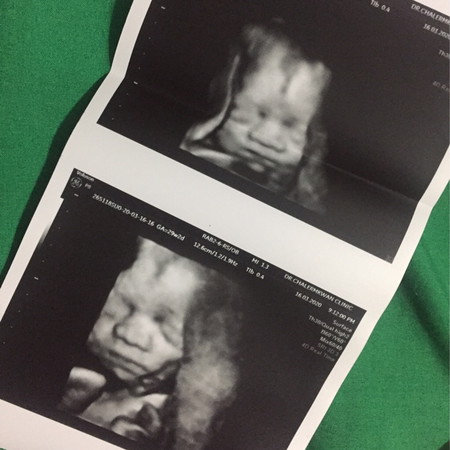 29w2d 7เดือนกว่าๆอีก2เดือนเจอกันเเล้ว